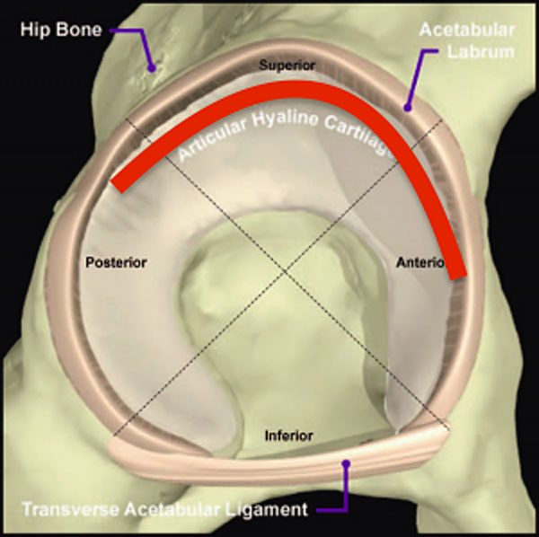 acetabular labrum common sites for tears of the labrum